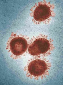 measles exposure Hamilton